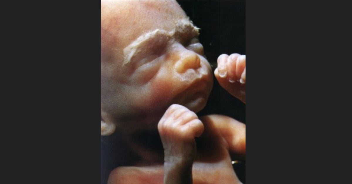 abortionist luxury abortion baby 23 weeks 01