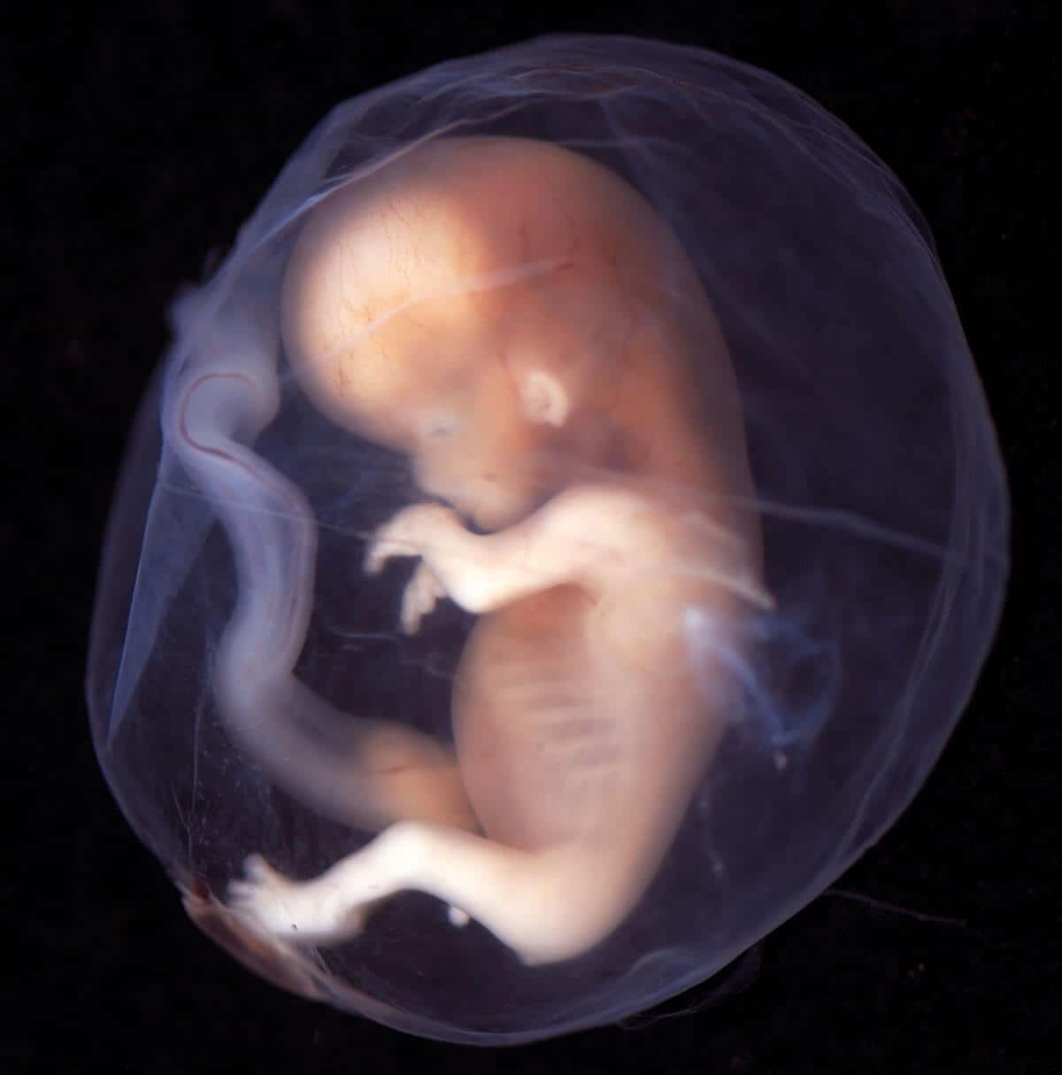 embryo 06